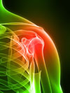 rotator cuff repair